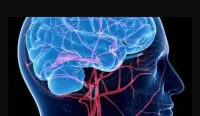 Understanding Glaucoma and Elevated IOP